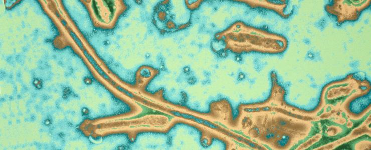Virus Ebola - Institut Pasteur