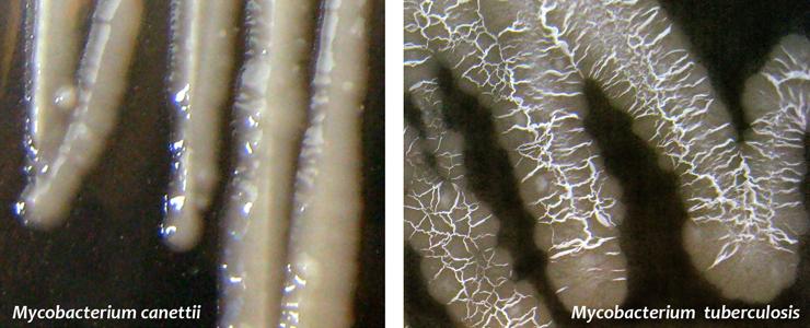 Tuberculose : découverte d’une étape critique de l’évolution du bacille vers la pathogénicité - Institut Pasteur Tuberculose : découverte d’une étape critique de l’évolution du bacille vers la pathogénicité - Institut Pasteur
