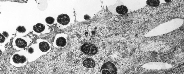 Neisseria meningitidis en cours d'adhésion et d'invasion des cellules épithéliales. © Institut Pasteur Neisseria meningitidis en cours d'adhésion et d'invasion des cellules épithéliales. © Institut Pasteur