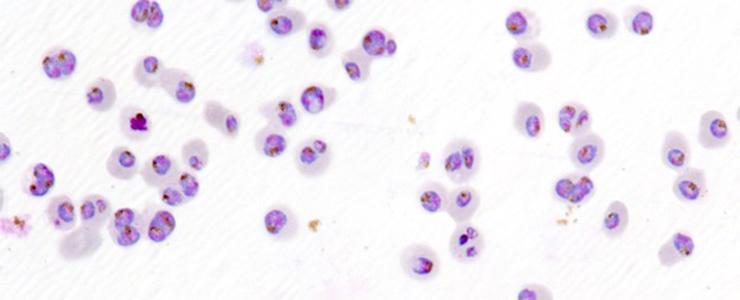 Paludisme - Découverte chez le parasite d'un marqueur moléculaire associé à la résistance au traitement à la piperaquine - Institut Pasteur