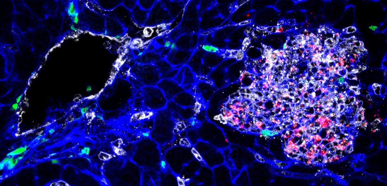 Listeria : des souches hypervirulentes à tropisme cérébral et placentaire - Institut Pasteur