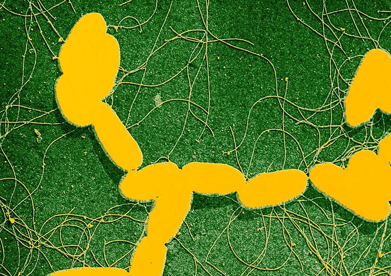 Presse - Espace Presse - Fiches maladies - Institut Pasteur Presse - Espace Presse - Fiches maladies - Institut Pasteur