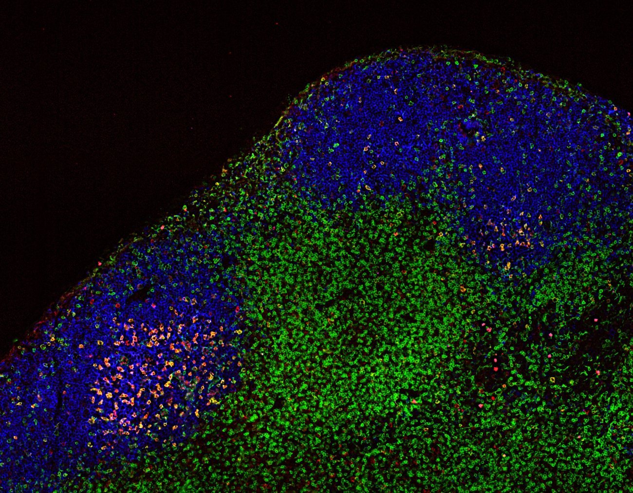Anticorps anti-PD-1 - cellules T - ganglions lymphatiques - Institut Pasteur Anticorps anti-PD-1 - cellules T - ganglions lymphatiques - Institut Pasteur