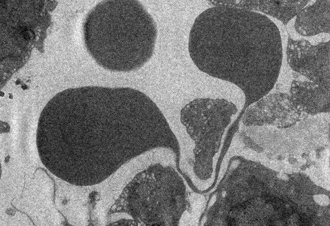 Globule rouge - rate humaine - Institut Pasteur