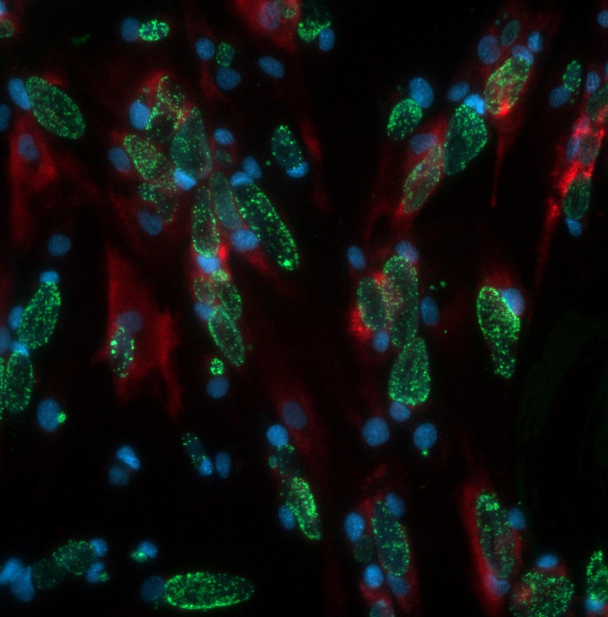 Chlamydia trachomatis - Institut Pasteur