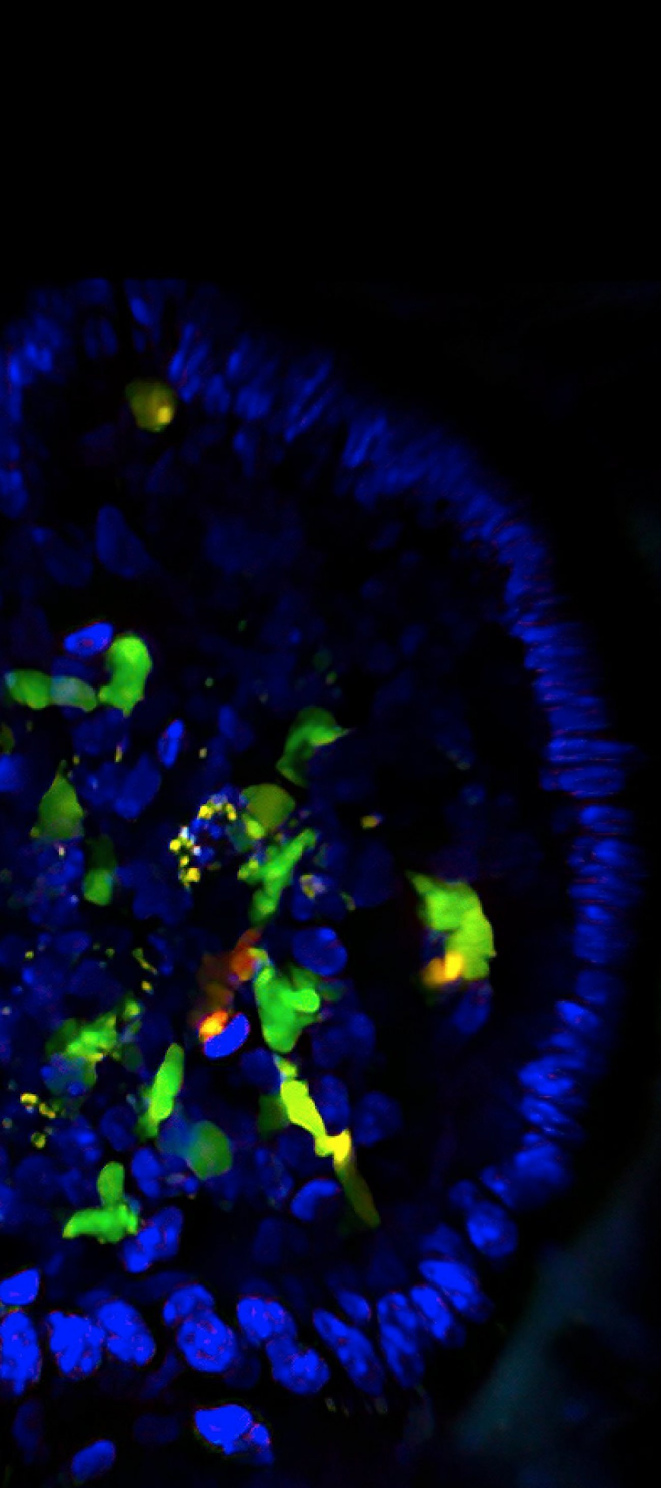 cellules lymphoïdes innées de type 3 - Institut Pasteur