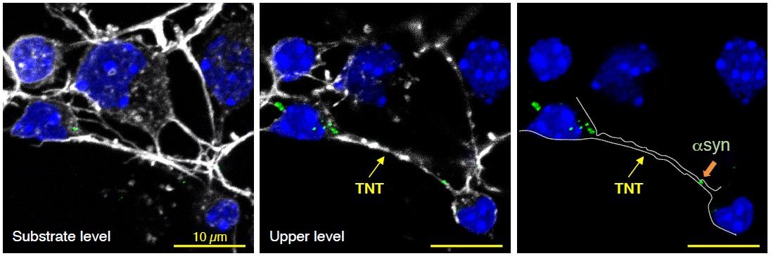 Nanotubes TNT - Institut Pasteur