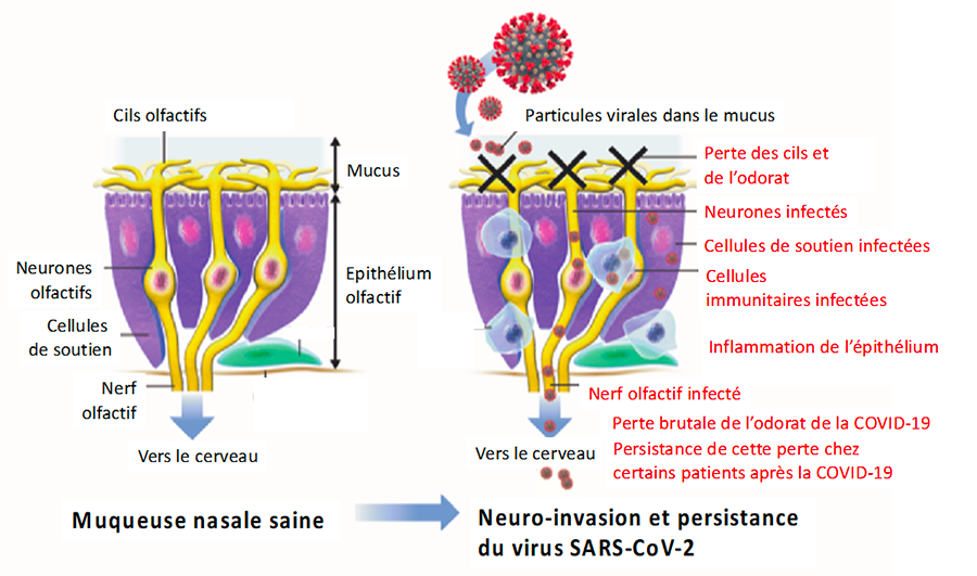 Illustration d'une muqueuse saine comparée à une Neuro-invasion et persistance au virus Sars-Cov2 Illustration muqueuse saine et muqueuse infectée au Sars-Cov2