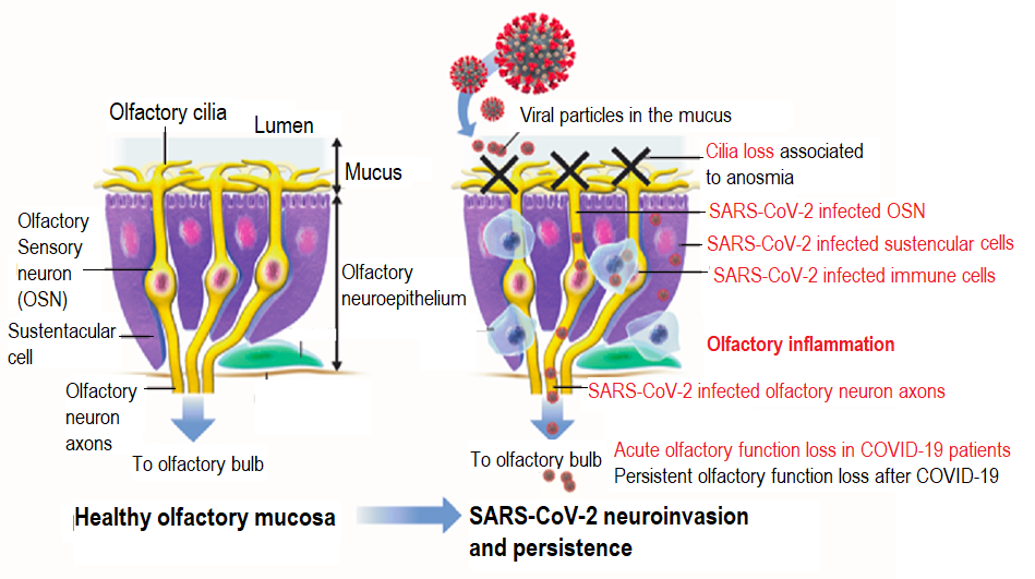 Anosmia - Covid - Long Covid - Institut Pasteur Anosmia - Covid - Long Covid - Institut Pasteur