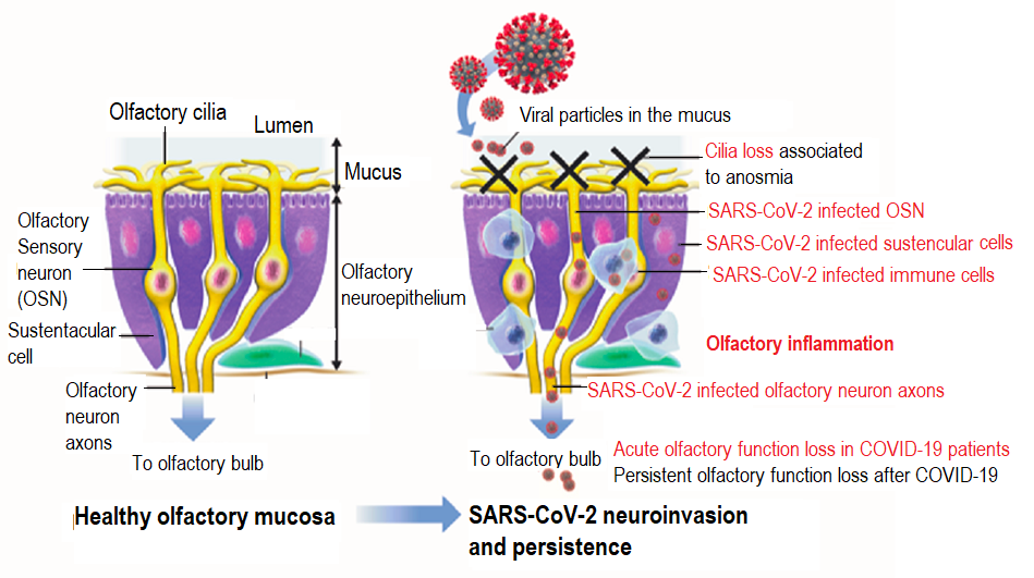 Anosmia - Covid - Long Covid - Institut Pasteur