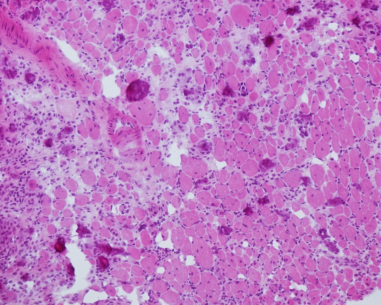 sepsis - Institut Pasteur sepsis - Institut Pasteur