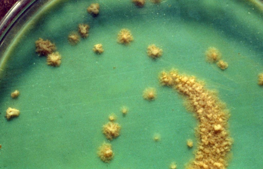 Mycobacterium bovis en culture - Institut Pasteur Mycobacterium bovis en culture - Institut Pasteur