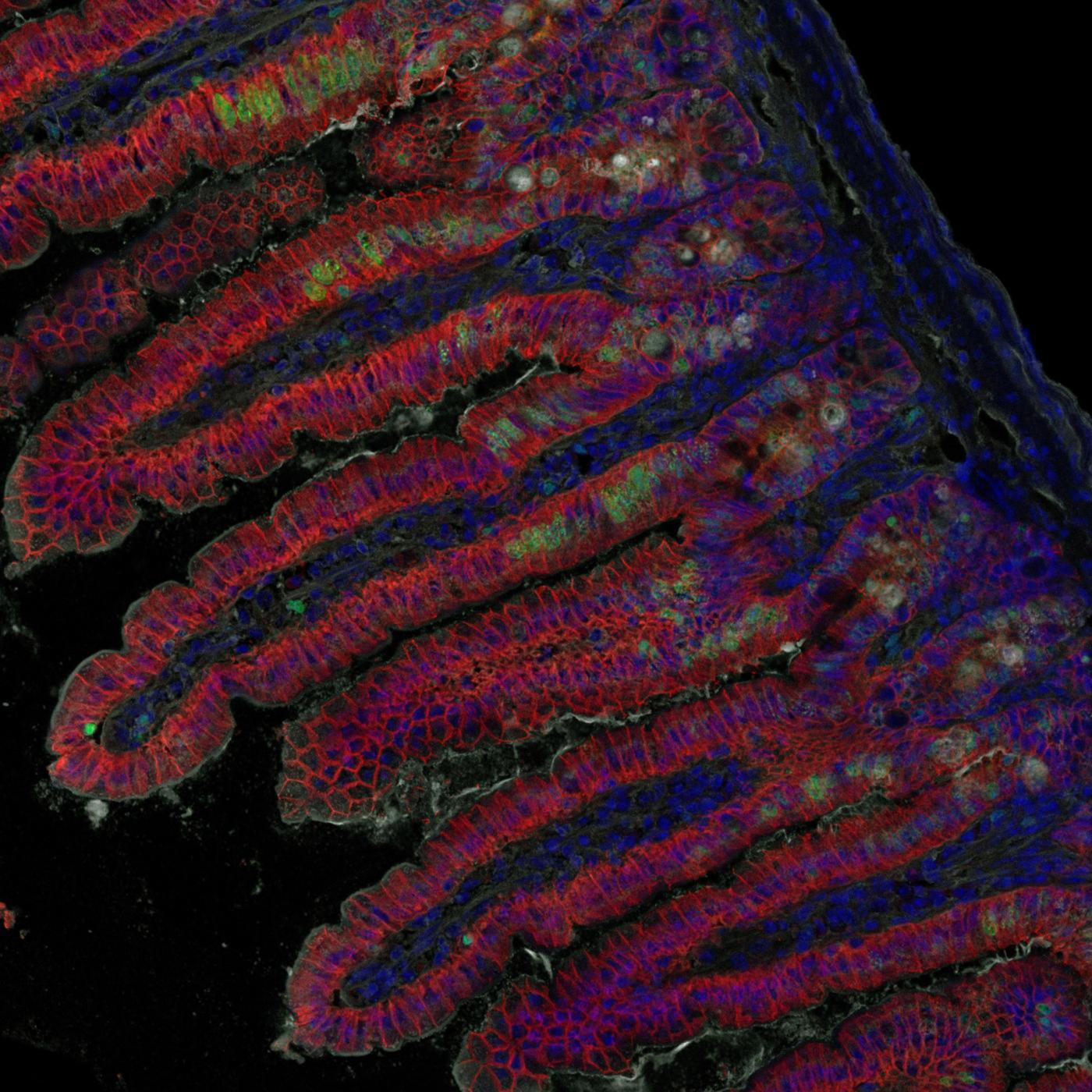 listeria - institut pasteur