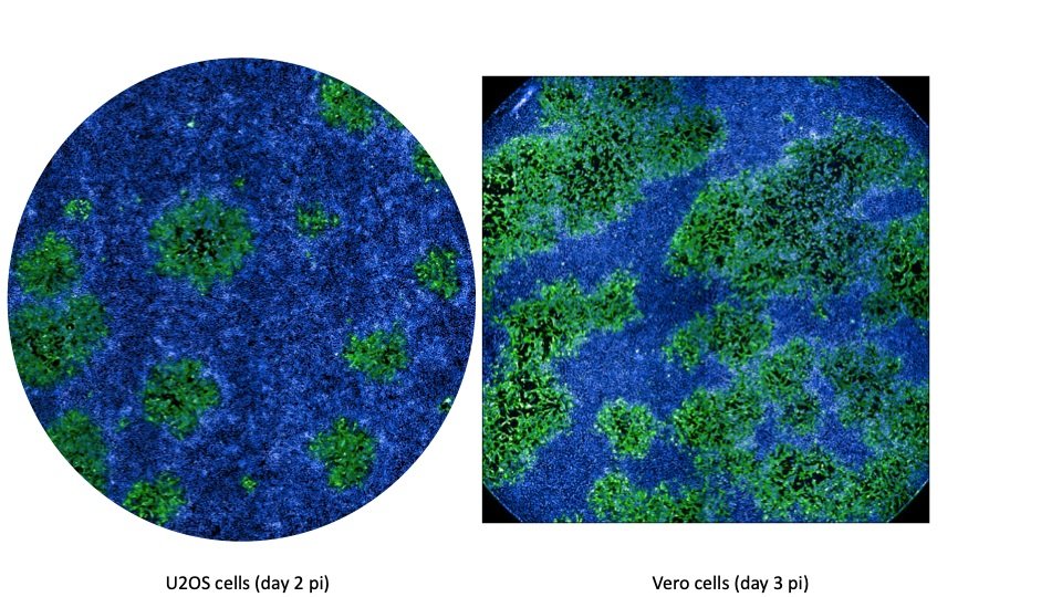 MonkeyPox - Institut Pasteur - marquage de cellules infectées