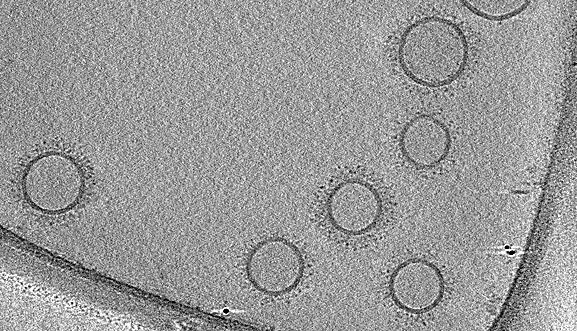 Cryptococcus neoformans - Institut Pasteur