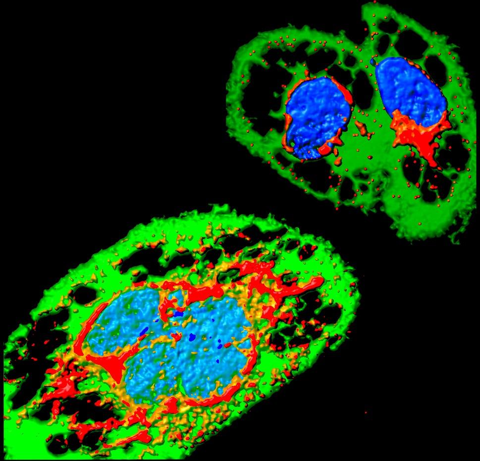 Zika infection - Institut Pasteur