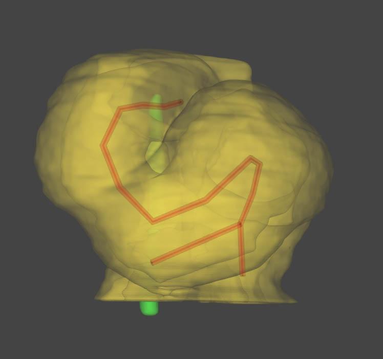 Reconstruction informatique de la forme du cœur embryonnaire montrant l'hélice 