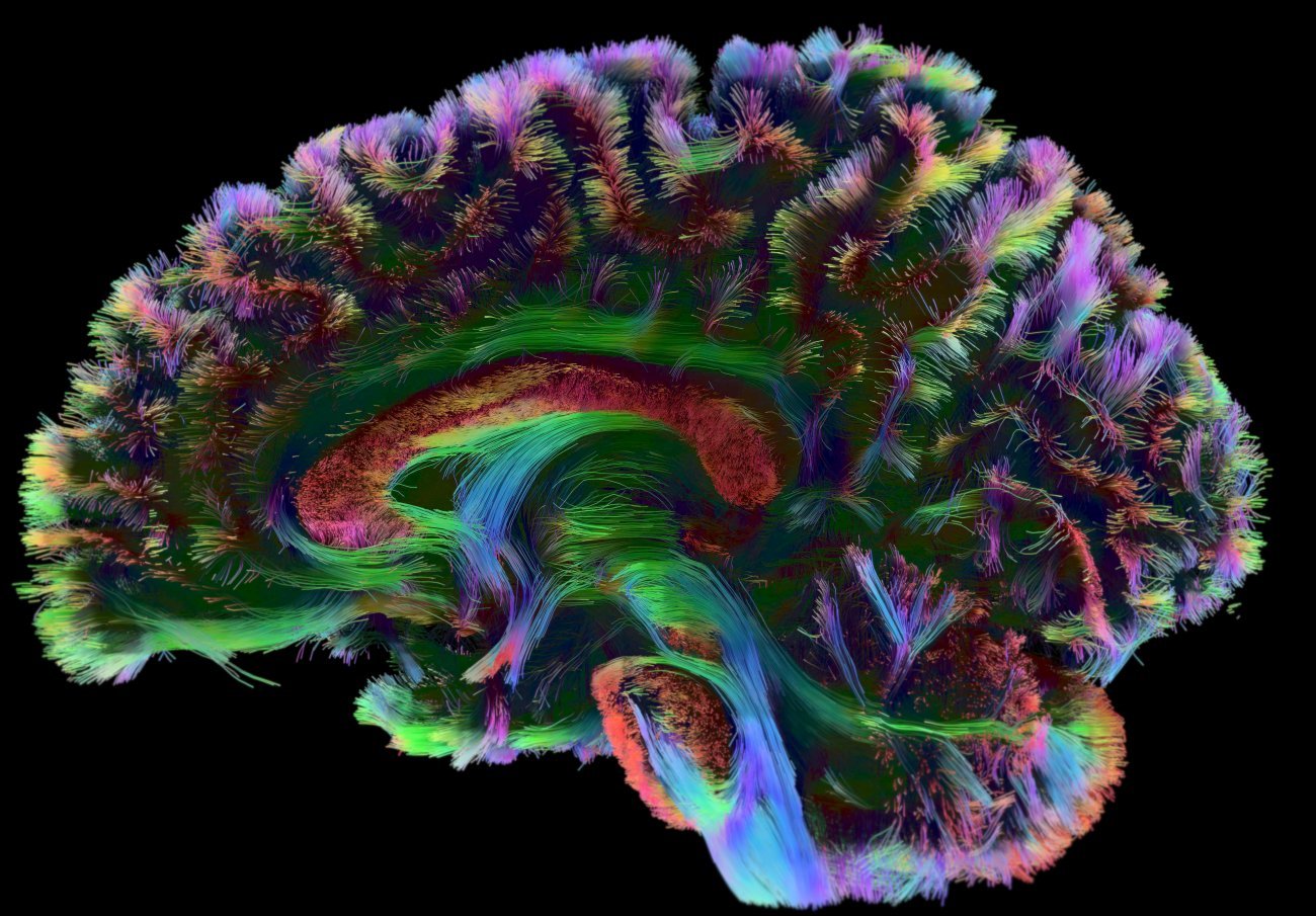 Cerveau - Institut Pasteur Cerveau - Institut Pasteur