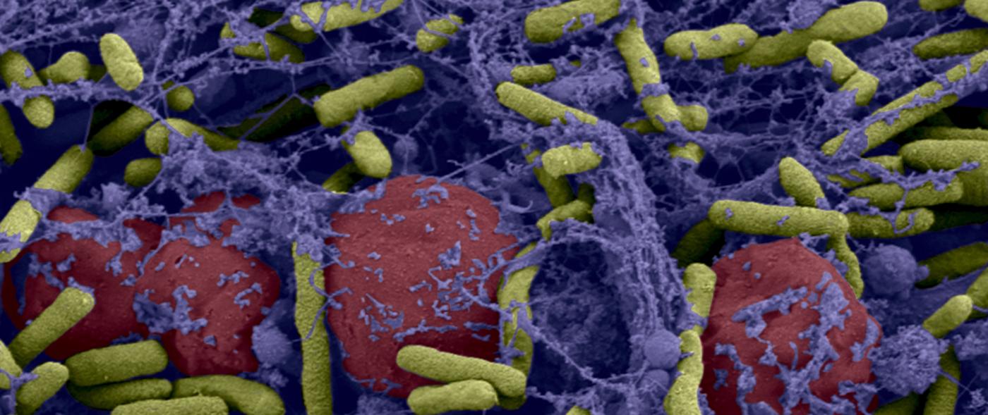 biofilm - Institut Pasteur