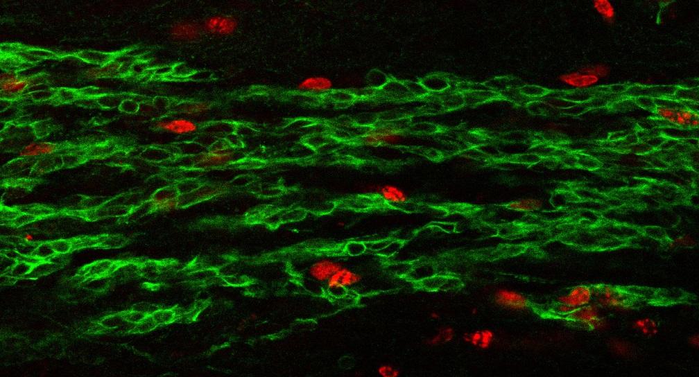 Migration néo-neurones chez adulte - Institut Pasteur