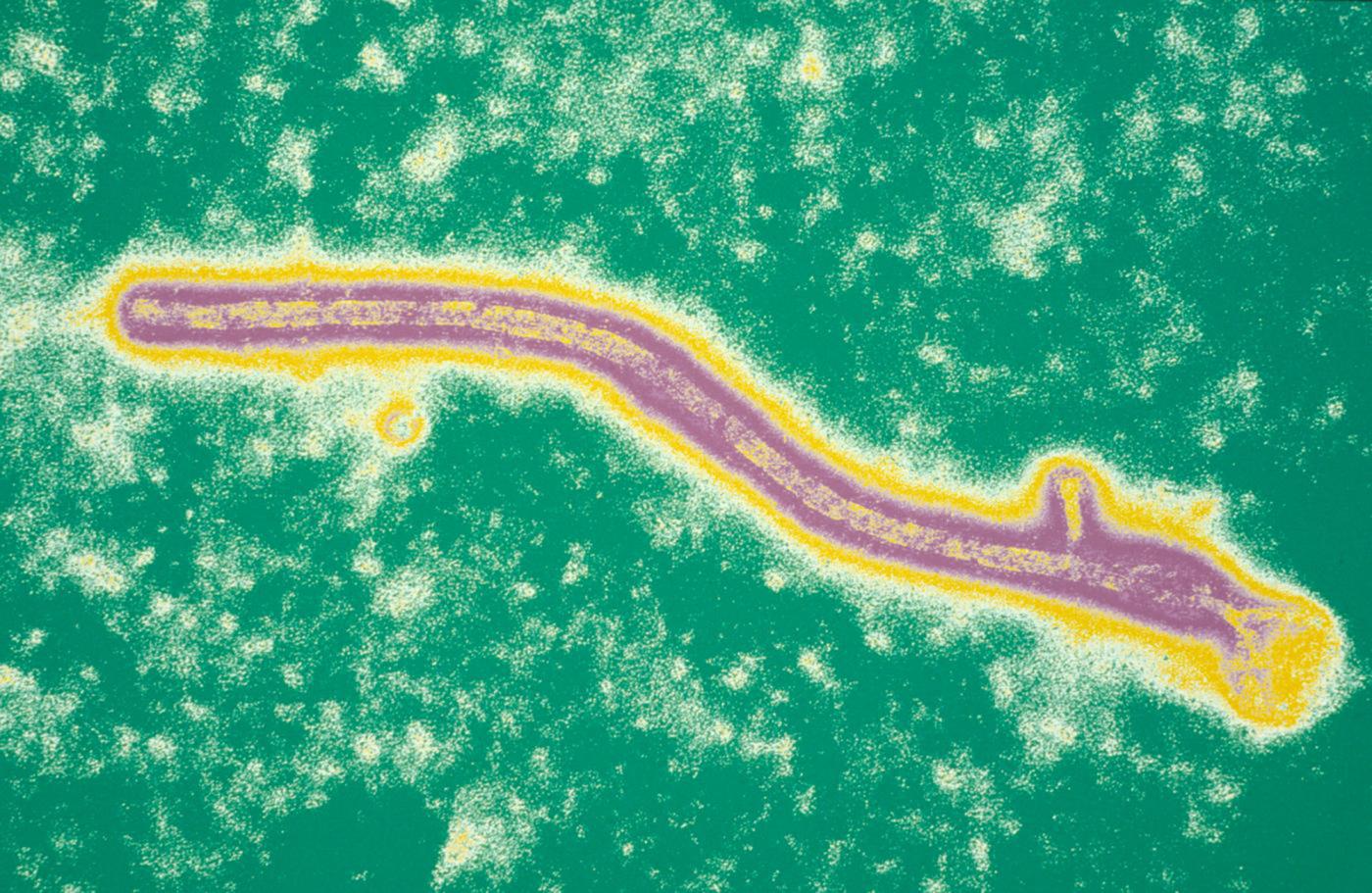 Ebola - Institut Pasteur Ebola - Institut Pasteur