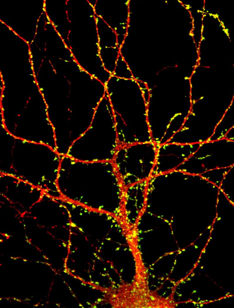 Microscopie d'un neurone. Le marquage jaune montre les synapses - Institut Pasteur