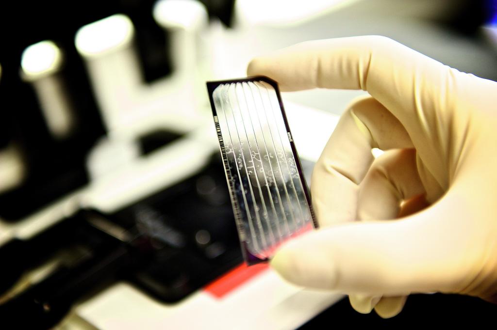 Séquençage ADN Illumina - Institut Pasteur