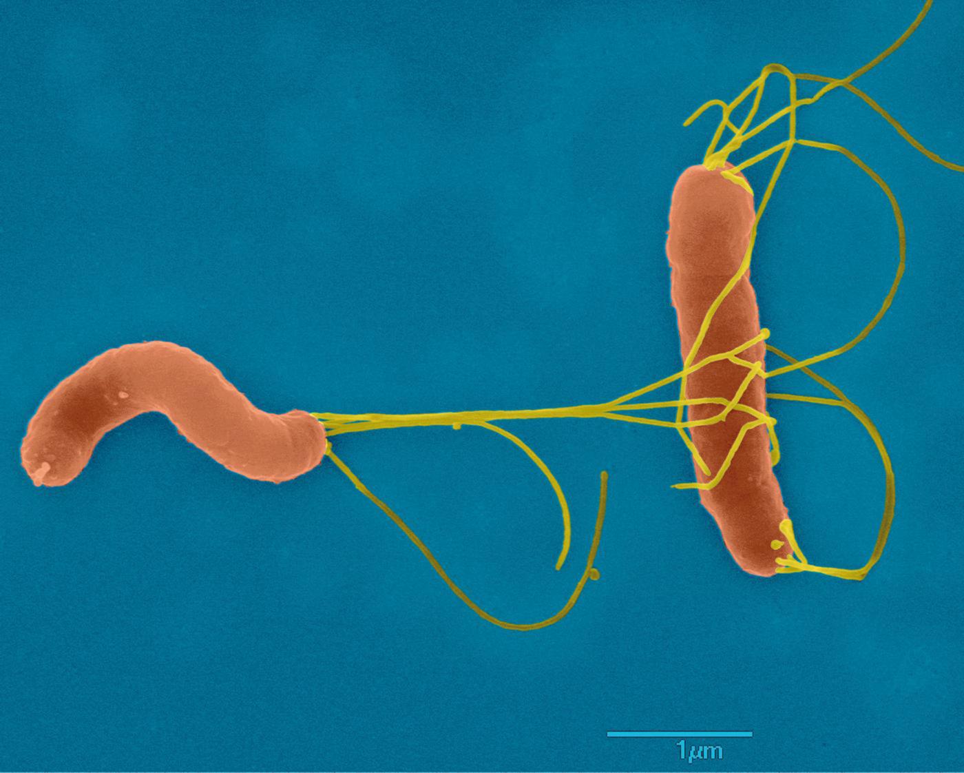Helicobacter pylori - Institut Pasteur