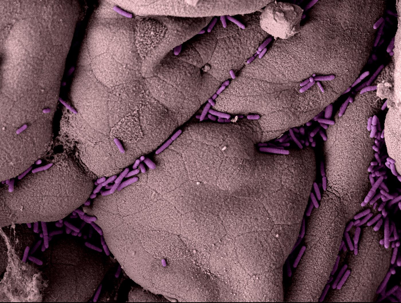 salmonella - institut pasteur salmonella - institut pasteur