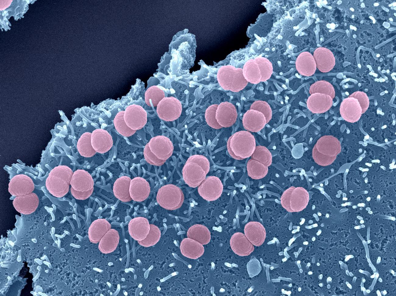 Méningites - Institut Pasteur