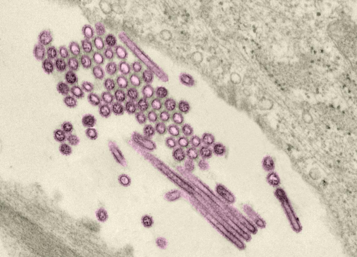 grippe A 2009 - H1N1 - Institut Pasteur 