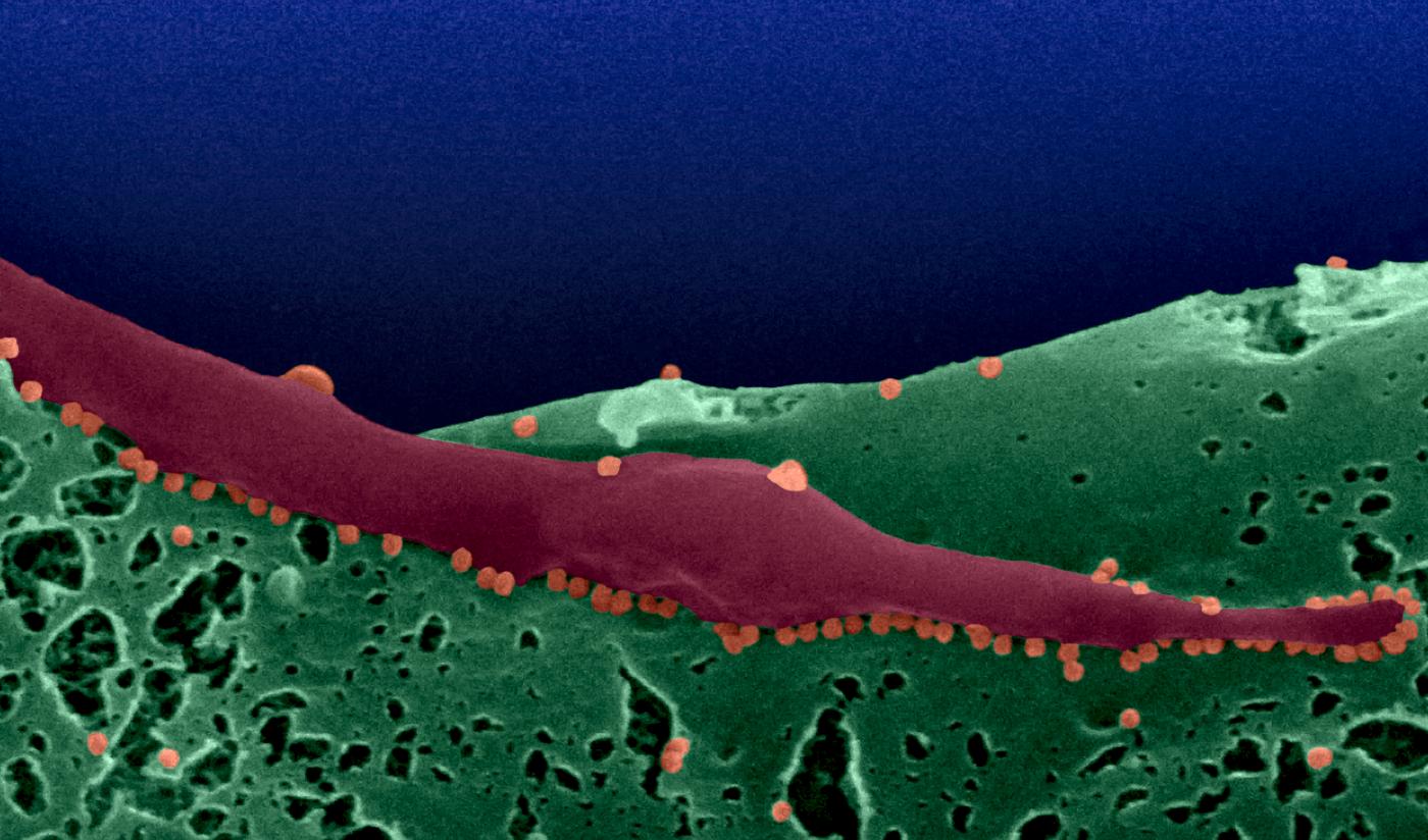 Chikungunya - Institut Pasteur