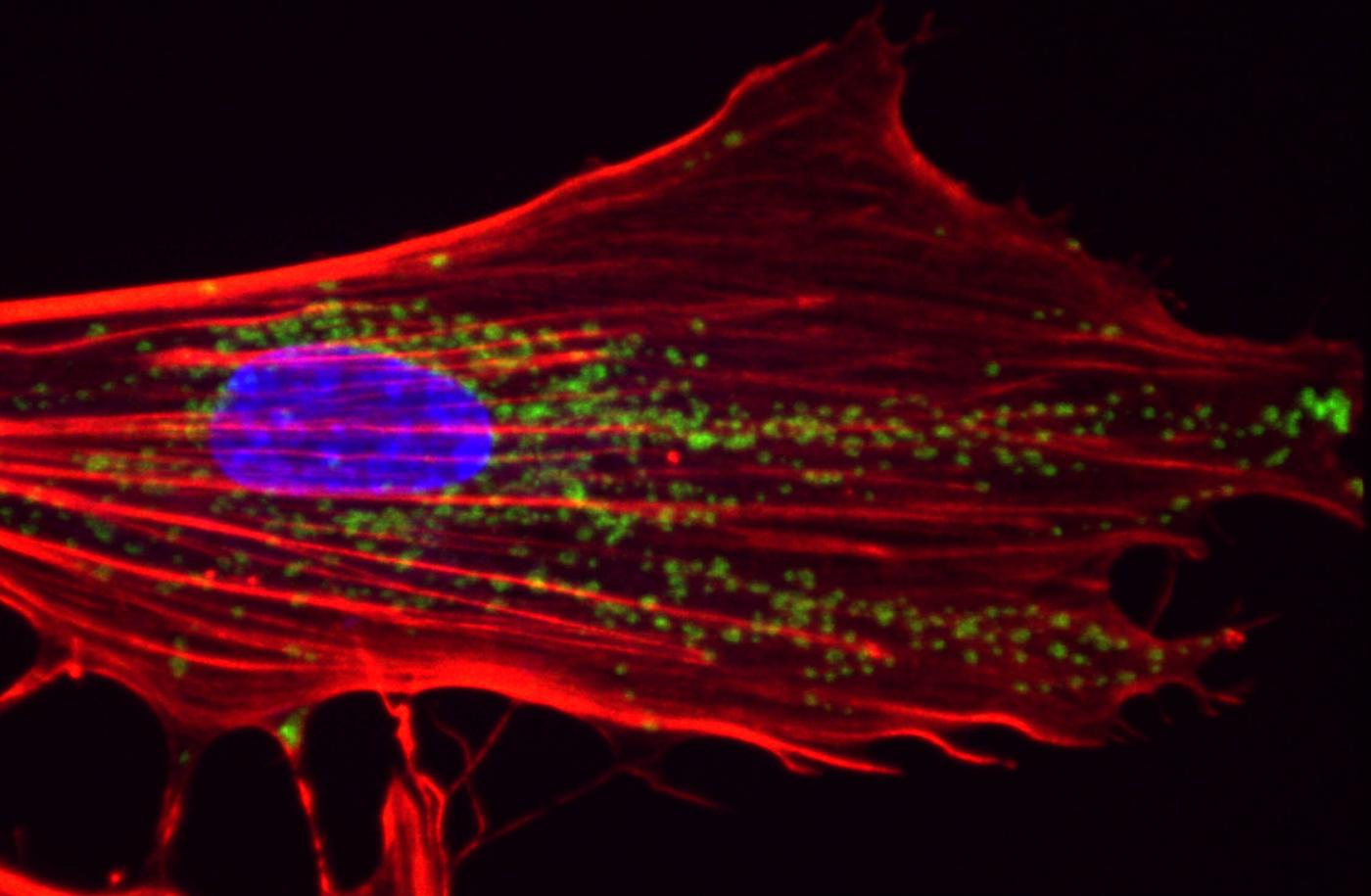 fibroblaste syndrome Cockayne - Institut Pasteur