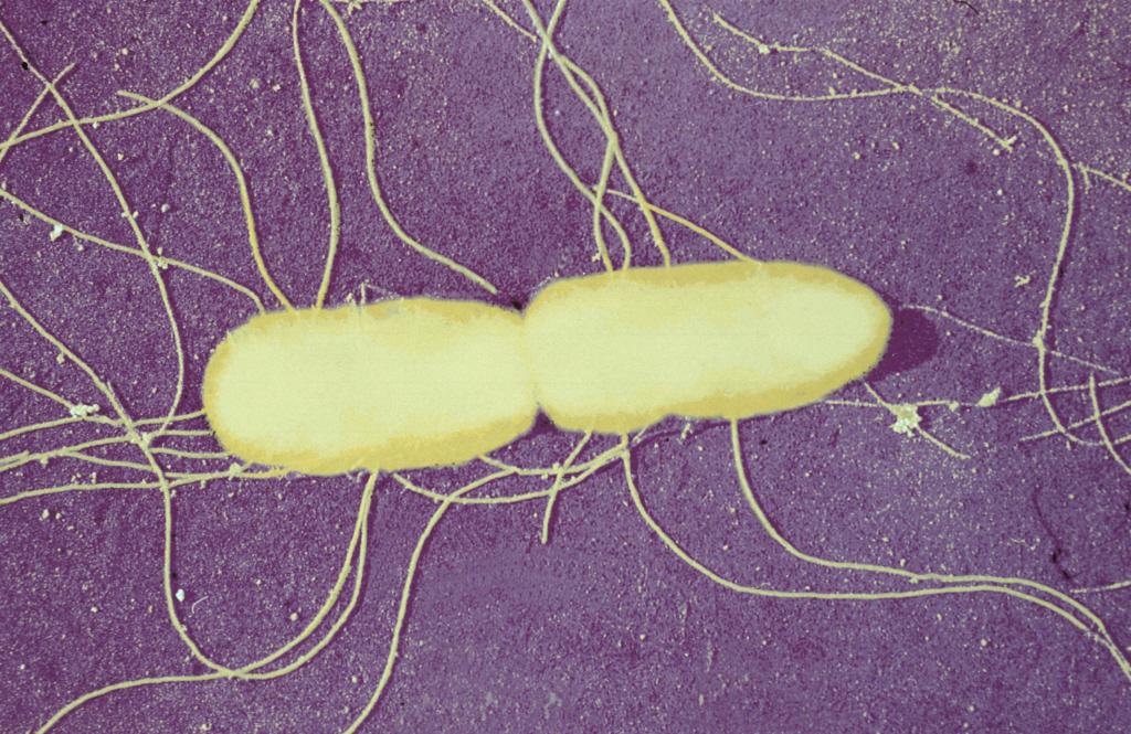 Salmonella typhimurium - Institut Pasteur  