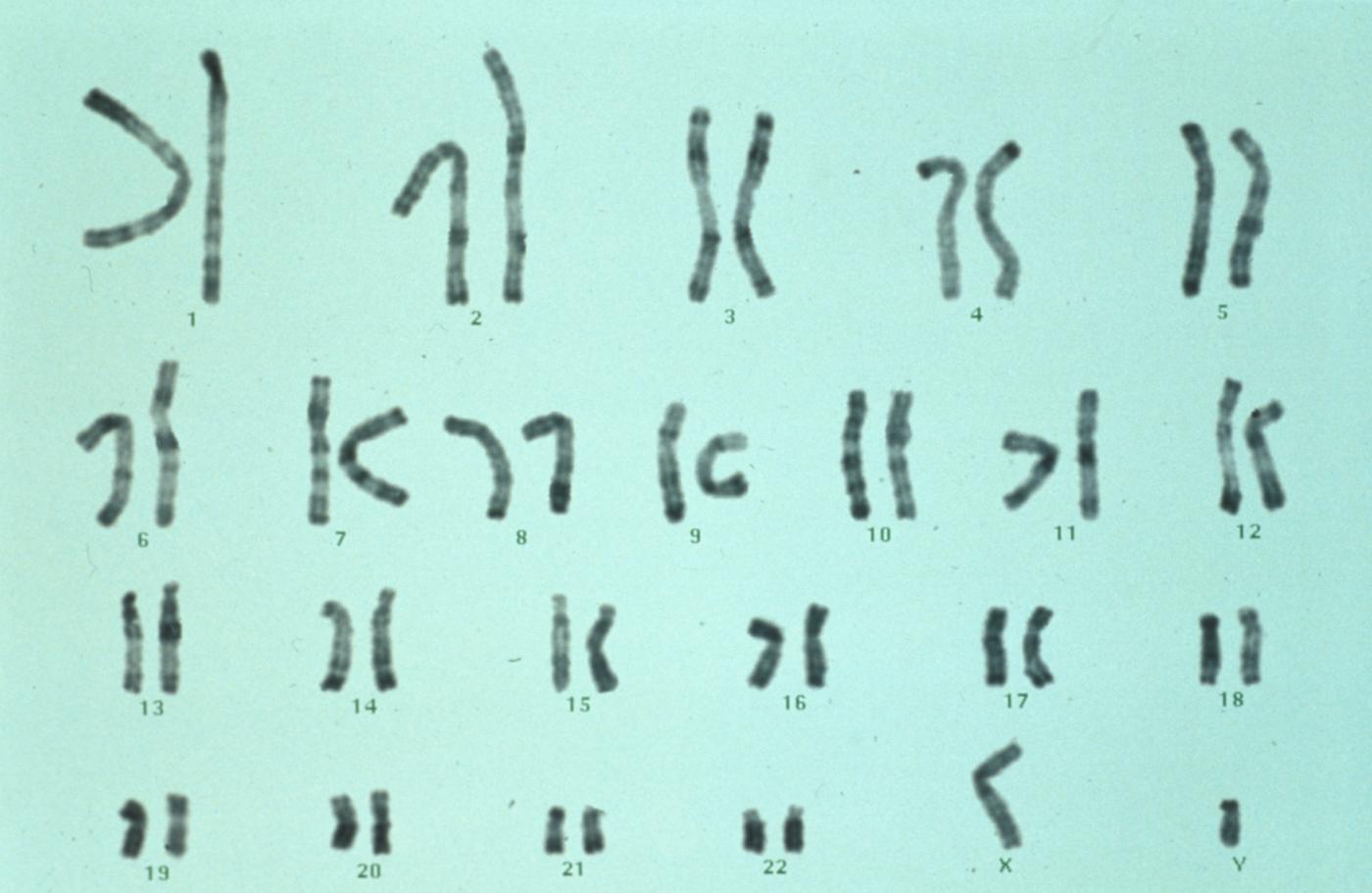 Caryotype chromosome - Institut Pasteur