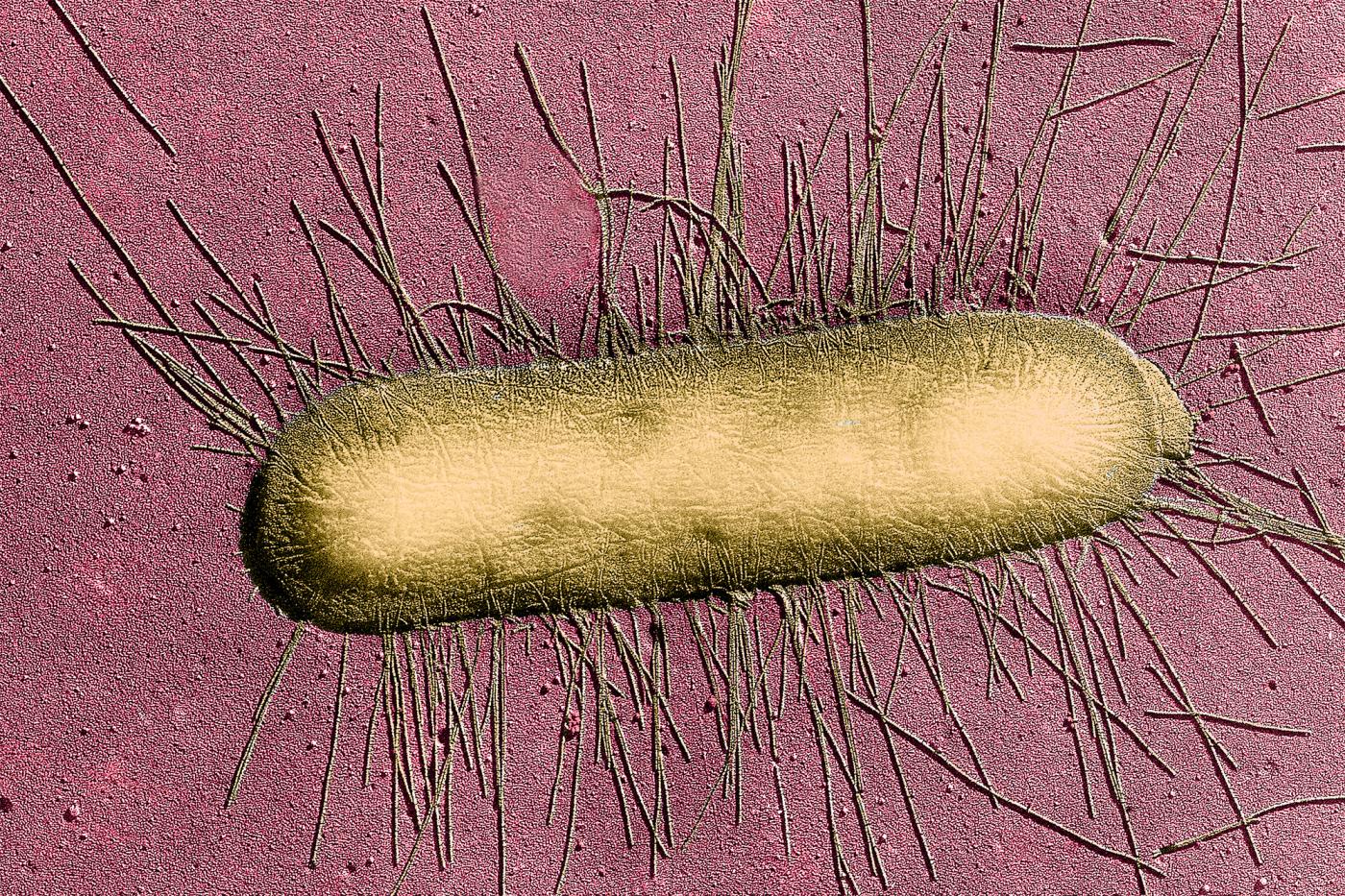 E. Coli - Institut Pasteur