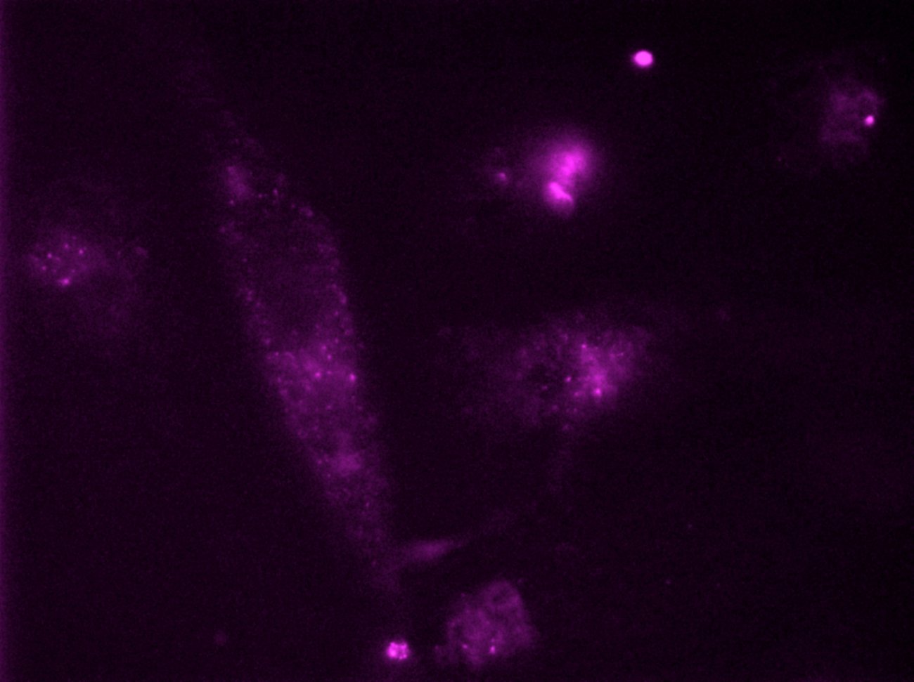 Les lymphocytes CD4 peuvent présenter des mutations au niveau du corécepteur CCR5 - © Institut Pasteur Les lymphocytes CD4 peuvent présenter des mutations au niveau du corécepteur CCR5 - © Institut Pasteur