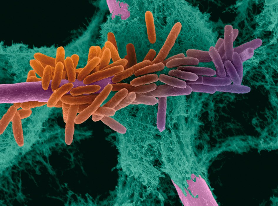 Interaction Aspergillus fumigatus et Pseudomonas aeruginosa, deux microorganismes du microbiote pulmonaire,  observée en microscopie électronique à balayage ©  Institut Pasteur