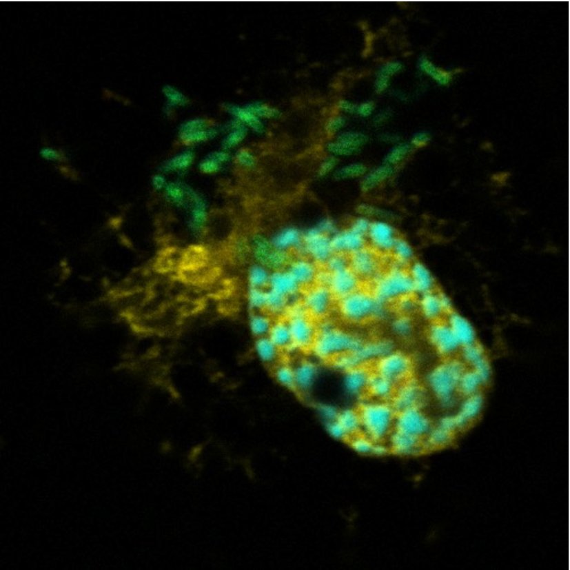 legionella pneumophila © Monica Rolando