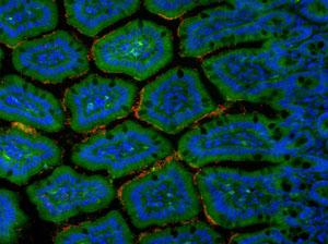 International - Les grands programmes - Afribiota - Institut Pasteur