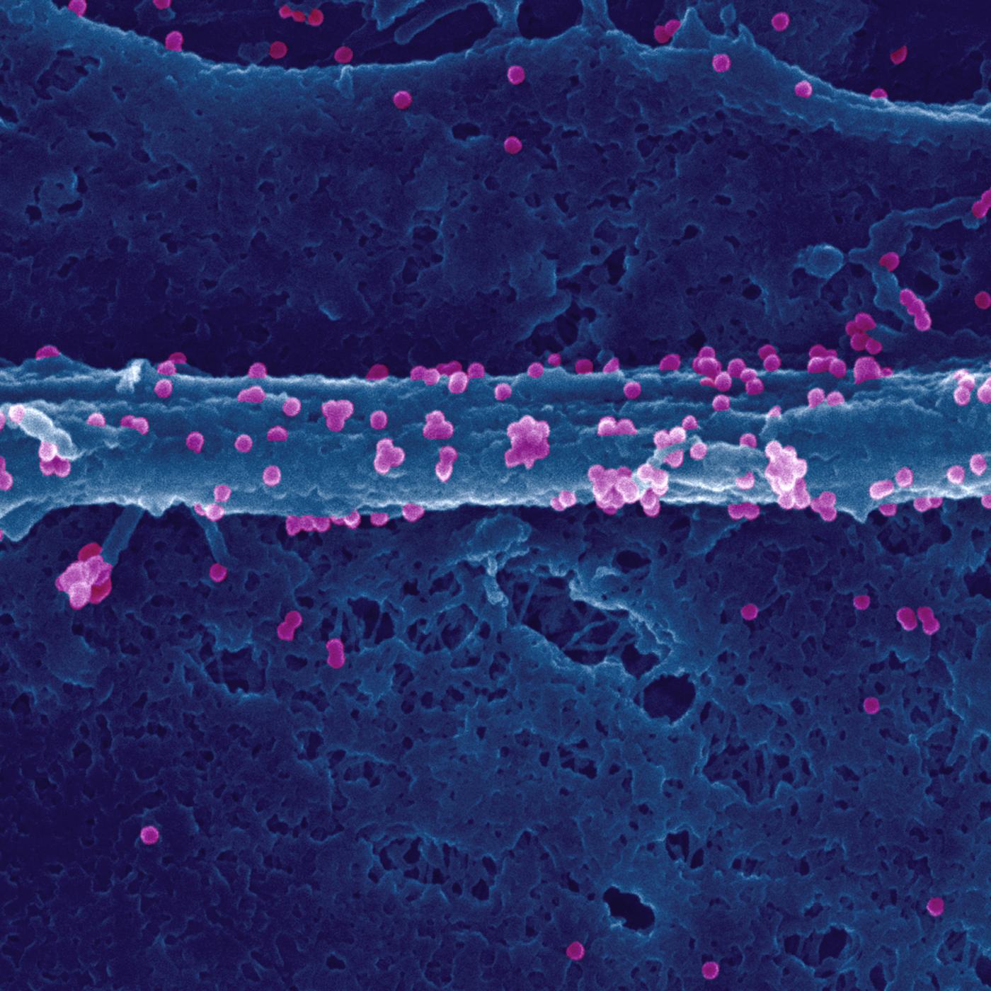 Virus chikungunya à la surface d'une cellule infectée - Institut Pasteur