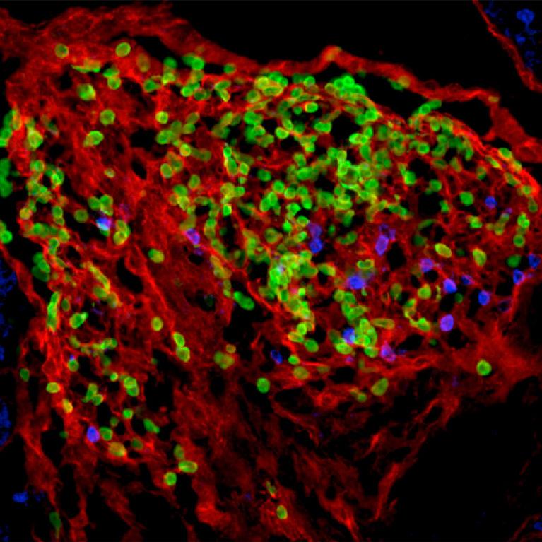 Un ganglion lymphatique en développement dans un foetus - Institut Pasteur