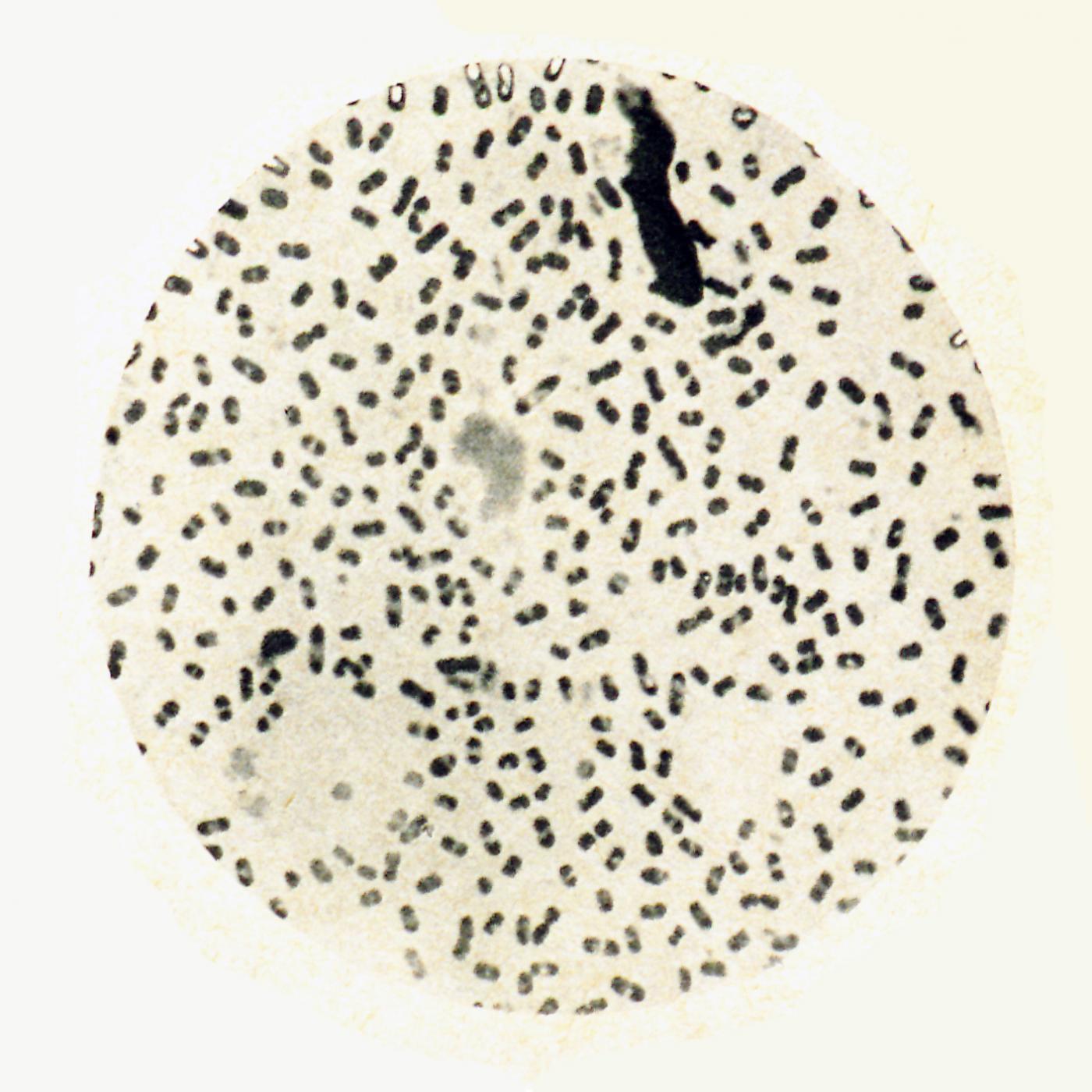 La peste bubonique à Hong-Kong par le Dr Yersin - Institut Pasteur