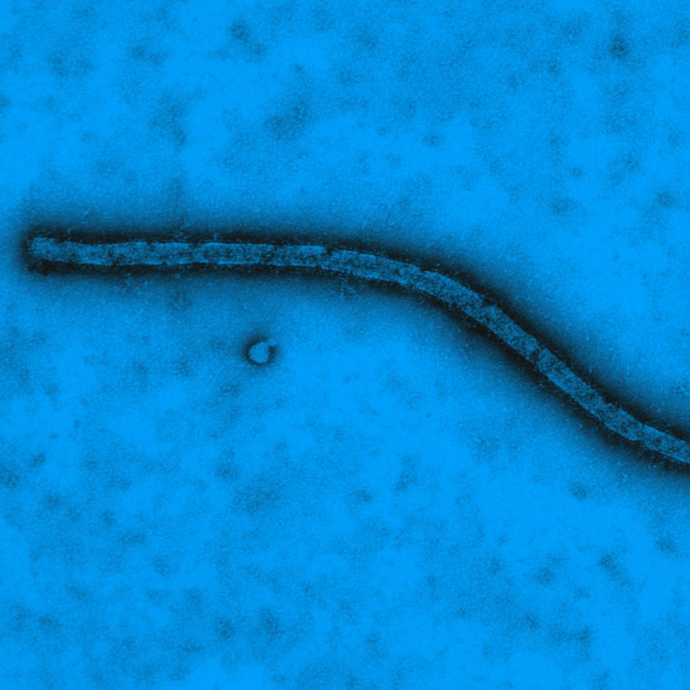 Virus Ebola vu en microscopie électronique à transmission - Institut Pasteur Virus Ebola vu en microscopie électronique à transmission - Institut Pasteur