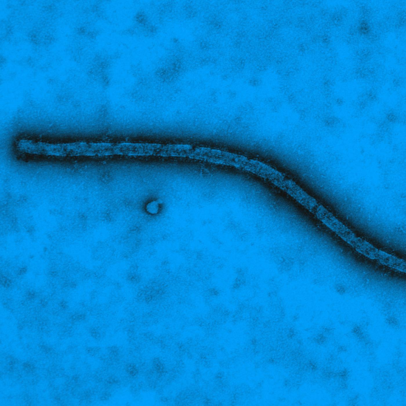 Virus Ebola vu en microscopie électronique à transmission - Institut Pasteur