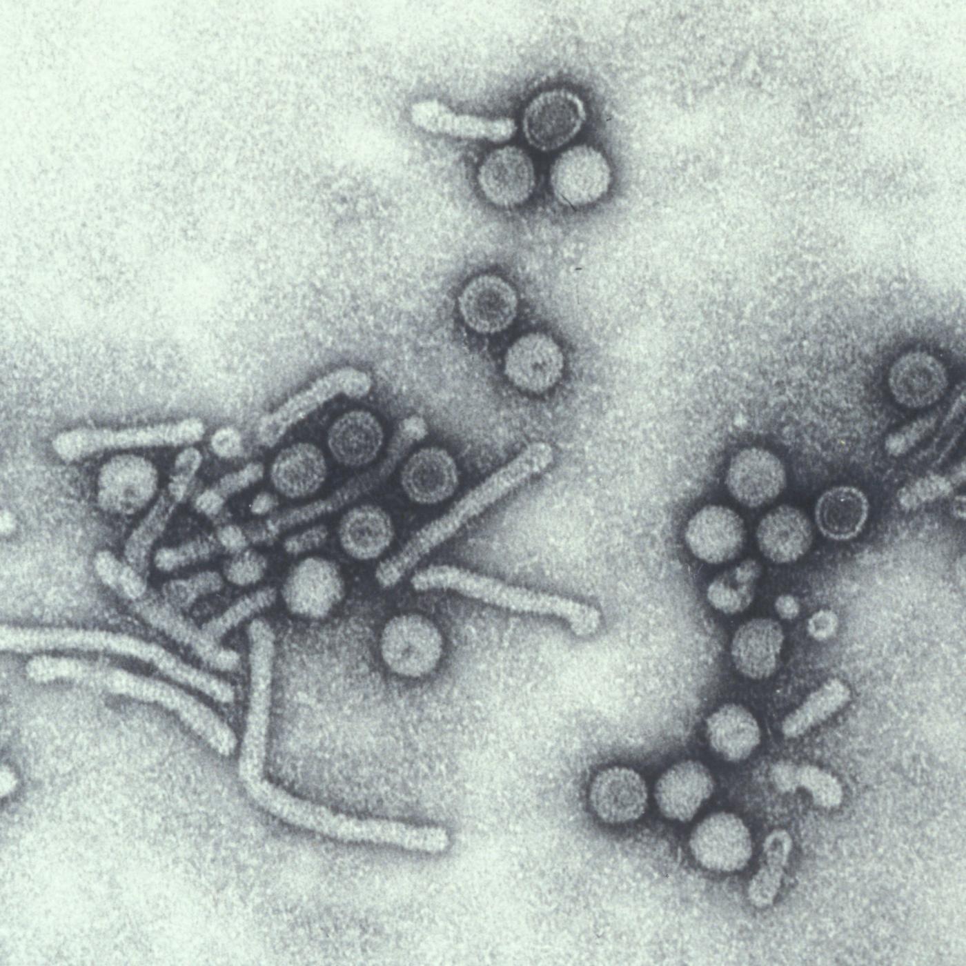 Virus de l'hépatite B - Institut Pasteur