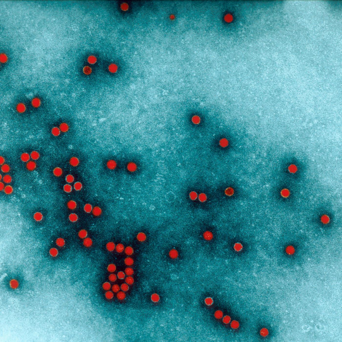 Poliovirus, agent de la poliomyélite. Image colorisée - Institut Pasteur