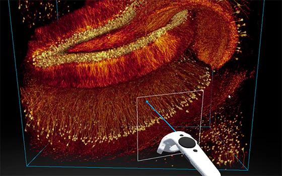 Brain connectivity and neurodegenerative diseases - Institut Pasteur