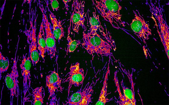 Brain connectivity and neurodegenerative diseases - Institut Pasteur