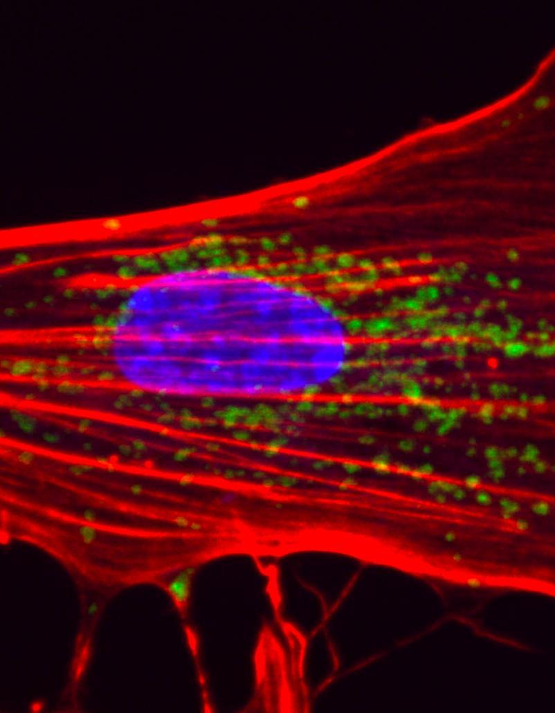 New therapies for brain disorders - Institut Pasteur